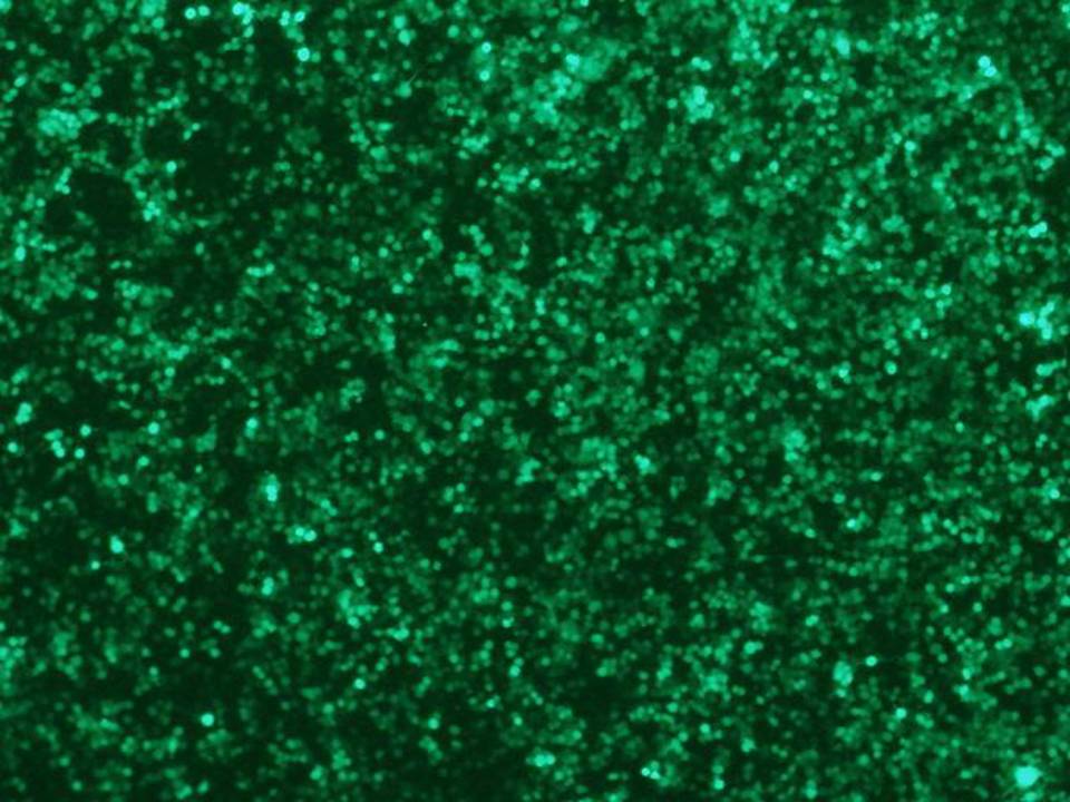 Neuro-2a - Mouse Neuroblastoma cells - Transfection Efficiency 90 per cent